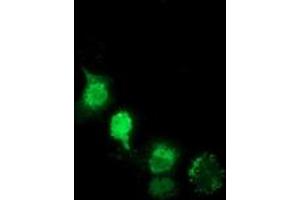 Anti-NHEJ1 mouse monoclonal antibody (ABIN2453349) immunofluorescent staining of COS7 cells transiently transfected by pCMV6-ENTRY NHEJ1 (RC203393). (NHEJ1 抗体)