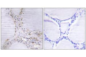 Immunohistochemistry analysis of paraffin-embedded human thyroid gland tissue using BMX antibody. (BMX 抗体  (N-Term))