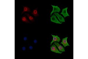 ABIN7093512 and ABIN7097536 staining Hela cells by IF/ICC. (YY1 抗体)