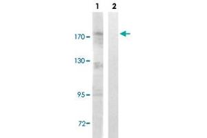 Western blot analysis of Lane 1: Untreated Jurkat cell lysates, Lane 2: Synthesized peptide treated Jurkat cell lysates reacted with TOP2A (phospho S1106) polyclonal antibody  at 1:500-1:3000 dilution.