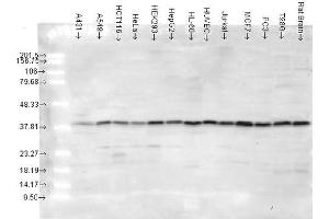 Western blot analysis of Human cancer cell lines showing detection of p38 protein using Rabbit Anti-p38 Polyclonal Antibody . (MAPK14 抗体  (Atto 488))