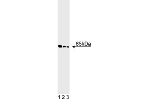 Western Blotting (WB) image for anti-Glutamate Decarboxylase 2 (Pancreatic Islets and Brain, 65kDa) (GAD2) antibody (ABIN967657) (GAD65 抗体)