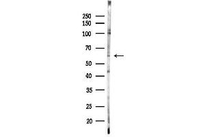 anti-Interleukin 2 Receptor, beta (IL2RB) (N-Term) antibody