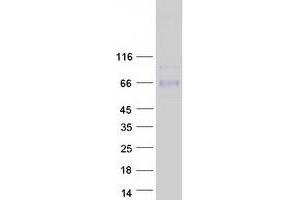 Validation with Western Blot