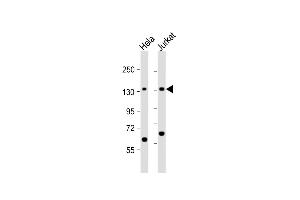 All lanes : Anti-SF3B3 Antibody (C-term) at 1:1000 dilution Lane 1: Hela whole cell lysate Lane 2: Jurkat whole cell lysate Lysates/proteins at 20 μg per lane. (SF3B3 抗体  (C-Term))