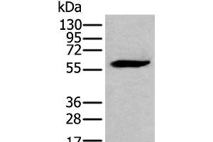 Western blot analysis of LNCAP cell lysate using EGR2 Polyclonal Antibody at dilution of 1:300 (EGR2 抗体)