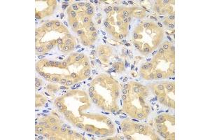 Immunohistochemistry of paraffin-embedded human kidney using ELMO3 antibody. (ELMO3 抗体  (AA 504-773))