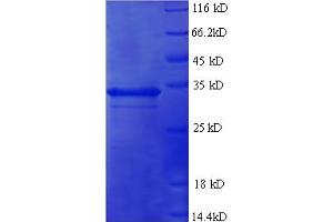 TNFAIP6 Protein (AA 18-277) (His tag)