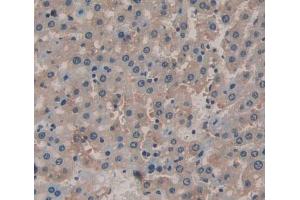 IHC-P analysis of Rat Tissue, with DAB staining. (IL-6 Receptor 抗体  (AA 385-462))