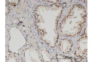 Image no. 1 for anti-Mediator Complex Subunit 6 (MED6) (AA 1-247) antibody (ABIN599504) (MED6 抗体  (AA 1-247))