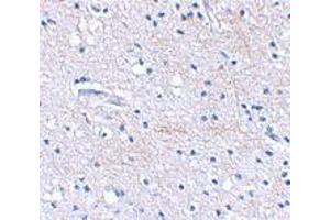 Immunohistochemical staining of human brain tissue using FBXL20 polyclonal antibody  at 2. (FBXL20 抗体  (C-Term))