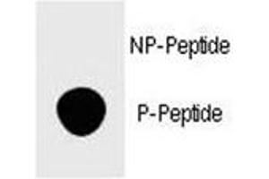 Dot blot analysis of phospho-FOXP3 antibody. (FOXP3 抗体  (pSer418))