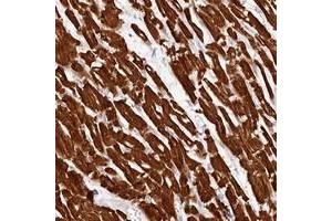 Immunohistochemical staining of human heart muscle with MYH15 polyclonal antibody  shows strong cytoplasmic positivity in myocytes. (MYH15 抗体)