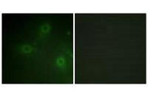 Immunofluorescence analysis of HeLa cells, using Neutrophil Cytosol Factor 1 (Ab-304) antibody. (NCF1 抗体  (Ser304))