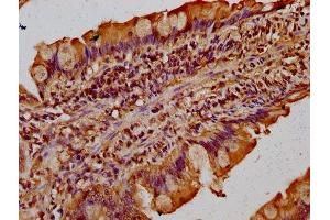 IHC image of ABIN7171569 diluted at 1:300 and staining in paraffin-embedded human small intestine tissue performed on a Leica BondTM system. (TMF1 抗体  (AA 878-986))