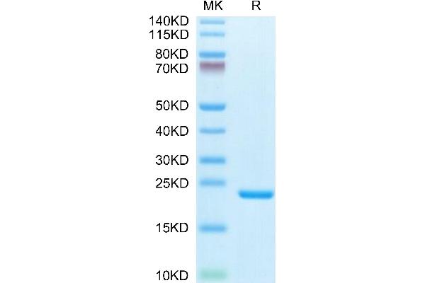 IL-1 beta Protein (AA 117-269) (His-Avi Tag,Biotin)