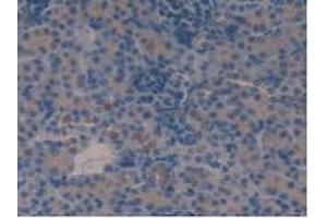 Detection of VIP in Mouse Kidney Tissue using Polyclonal Antibody to Vasoactive Intestinal Peptide (VIP) (Vip 抗体  (AA 28-159))