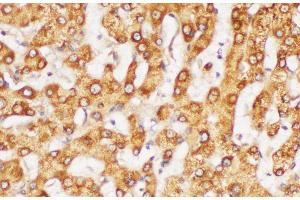 Immunohistochemistry of paraffin-embedded Human liver using FGG Polycloanl Antibody at dilution of 1:200 (FGG 抗体)