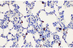 Immunohistochemistry of paraffin-embedded Rat lung using S100a8 Polycloanl Antibody at dilution of 1:200 (S100A8 抗体)