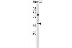 Western Blotting (WB) image for anti-Endonuclease 8-like 2 (NEIL2) antibody (ABIN5018074) (NEIL2 抗体)