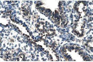 Rabbit Anti-TSC22D4 Antibody Catalog Number: ARP30107 Paraffin Embedded Tissue: Human Lung Cellular Data: Alveolar cells Antibody Concentration: 4. (TSC22D4 抗体  (N-Term))
