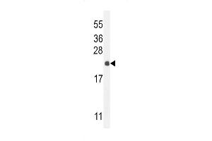 Western blot analysis in mouse liver tissue lysates (35ug/lane). (hCG_2024410 (AA 187-215), (C-Term) 抗体)