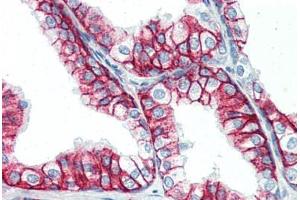 Human Prostate (formalin-fixed, paraffin-embedded) stained with BSG antibody ABIN396957 at 10 ug/ml followed by biotinylated anti-mouse IgG secondary antibody ABIN481714, alkaline phosphatase-streptavidin and chromogen. (CD147 抗体)