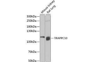 Western blot analysis of extracts of various cell lines, using TR antibody (ABIN6129150, ABIN6149471, ABIN6149472 and ABIN6222518) at 1:1000 dilution. (TRAPPC10 抗体  (AA 1-260))