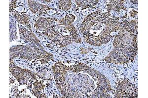 IHC analysis of TFEB using anti-TFEB antibody (ABIN7600648). (TFEB 抗体  (AA 214-326))