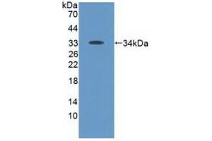 Detection of Recombinant Tyk2, Human using Polyclonal Antibody to Tyrosine Kinase 2 (Tyk2) (TYK2 抗体  (AA 915-1173))