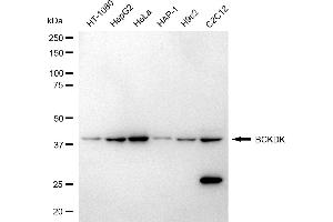 Western blotting analysis using BCKDK antibody (ABIN7797783). (BCKDK 抗体)