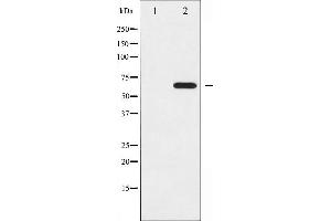 Western blot analysis of Ezrin phosphorylation expression in EGF treated A431 whole cell lysates,The lane on the left is treated with the antigen-specific peptide.