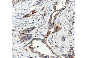 IHC analysis of FOXO3A using anti-FOXO3A antibody (ABIN3042404). (FOXO3 抗体  (AA 471-673))