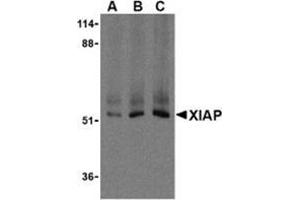 Western blot analysis of XIAP in Human kidney lysate using AP30993PU-N XIAP antibody at 0. (XIAP 抗体  (C-Term))