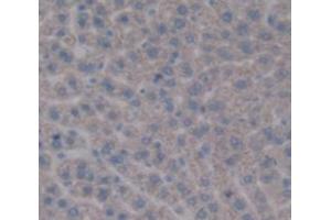 IHC-P analysis of Rat Tissue, with DAB staining. (PYGL 抗体  (AA 603-750))