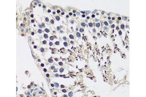 Immunohistochemistry of paraffin-embedded Rat testis using CASC5 Polyclonal Antibody at dilution of 1:100 (40x lens). (CASC5 抗体)