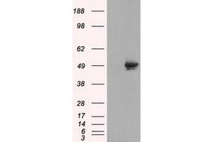 Image no. 1 for anti-CUGBP, Elav-Like Family Member 1 (CELF1) antibody (ABIN1497686)