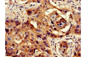 Immunohistochemistry (IHC) image for anti-Protein Phosphatase 1, Catalytic Subunit, beta Isoform (PPP1CB) (AA 175-221), (Catalytic Subunit) antibody (ABIN7169308)