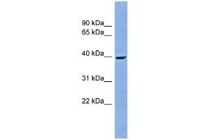 ACPP antibody used at 1 ug/ml to detect target protein. (ACPP 抗体  (Middle Region))