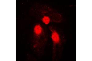 Immunofluorescent analysis of SMAD3 (pS204) staining in HeLa cells. (SMAD3 抗体  (pSer204))