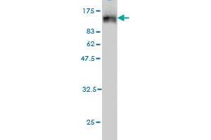 Western Blot detection against Immunogen (120. (TOP3B 抗体  (AA 1-862))