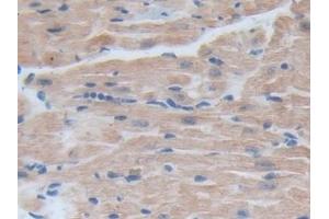 Immunohistochemistry (IHC) image for anti-Bromodomain Containing 8 (BRD8) (AA 797-951) antibody (ABIN7443590)