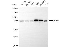Western blotting analysis using SUN2 antibody (ABIN7800269). (Recombinant SUN2 抗体)