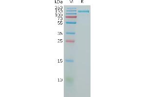 SDS-PAGE (SDS) image for Vascular Cell Adhesion Molecule 1 (VCAM1) (AA 25-698) protein (Fc Tag) (ABIN7491219)