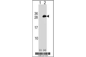 Western blot analysis of UBE2T using rabbit polyclonal UBE2T Antibody using 293 cell lysates (2 ug/lane) either nontransfected (Lane 1) or transiently transfected (Lane 2) with the UBE2T gene. (Ube2t 抗体  (C-Term))