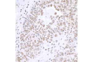 Immunohistochemistry (IHC) image for anti-Breast Carcinoma Amplified Sequence 2 (BCAS2) (C-Term) antibody (ABIN7453423) (BCAS2 抗体  (C-Term))