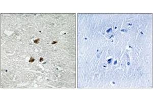 Immunohistochemistry analysis of paraffin-embedded human brain, using HSF1 (Phospho-Ser121) Antibody. (HSF1 抗体  (pSer121))