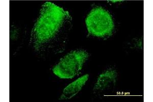 Immunofluorescence of monoclonal antibody to BCAP29 on HeLa cell. (BCAP29 抗体  (AA 125-241))