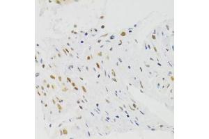 Immunohistochemistry (Paraffin-embedded Sections) (IHC (p)) image for anti-Nuclear Autoantigenic Sperm Protein (Histone-Binding) (NASP) (AA 180-449) antibody (ABIN6144374)