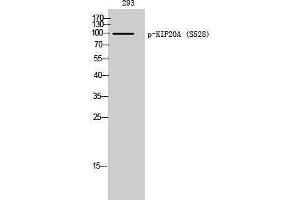 Western Blotting (WB) image for anti-Kinesin Family Member 20A (KIF20A) (pSer528) antibody (ABIN3182270) (KIF20A 抗体  (pSer528))